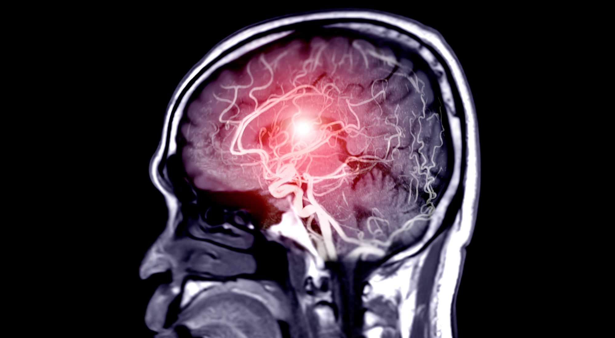 groundbreaking-study-to-determine-long-term-concussion-effects